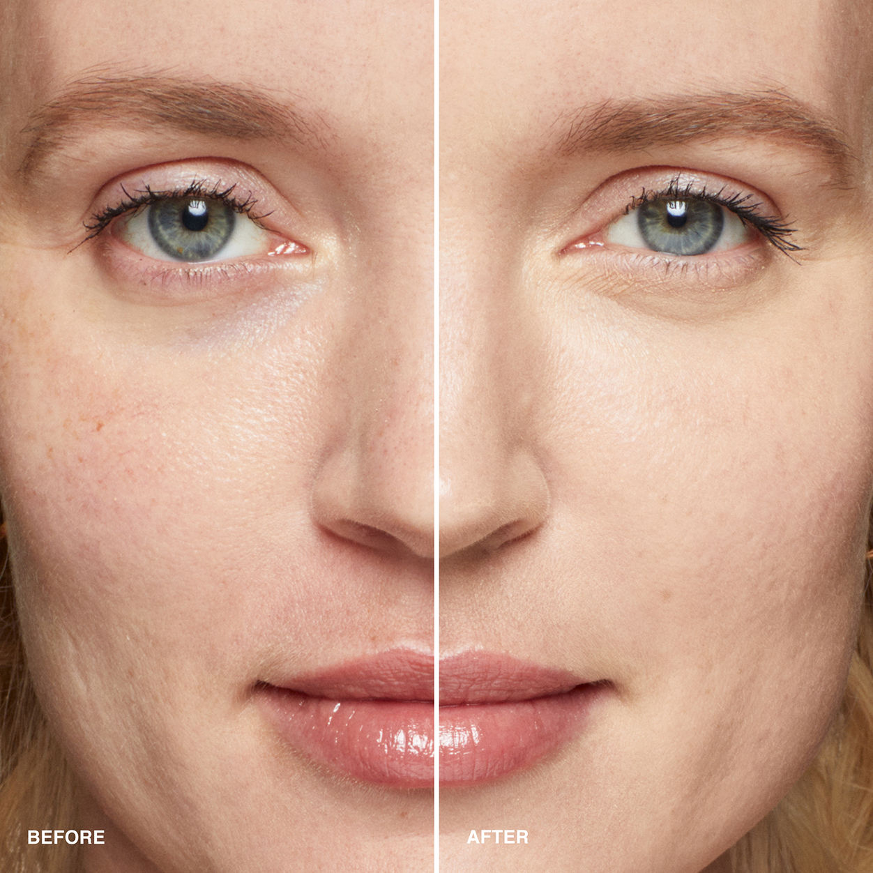 Before and after results of using Bobbi Brown Skin Concealer Stick variant: Cool Sand