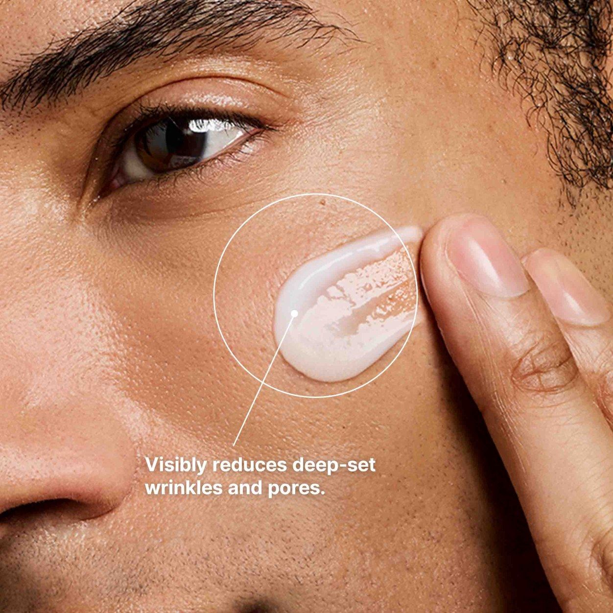 Before and after results of using P-TIOX Cream variant: Default Title