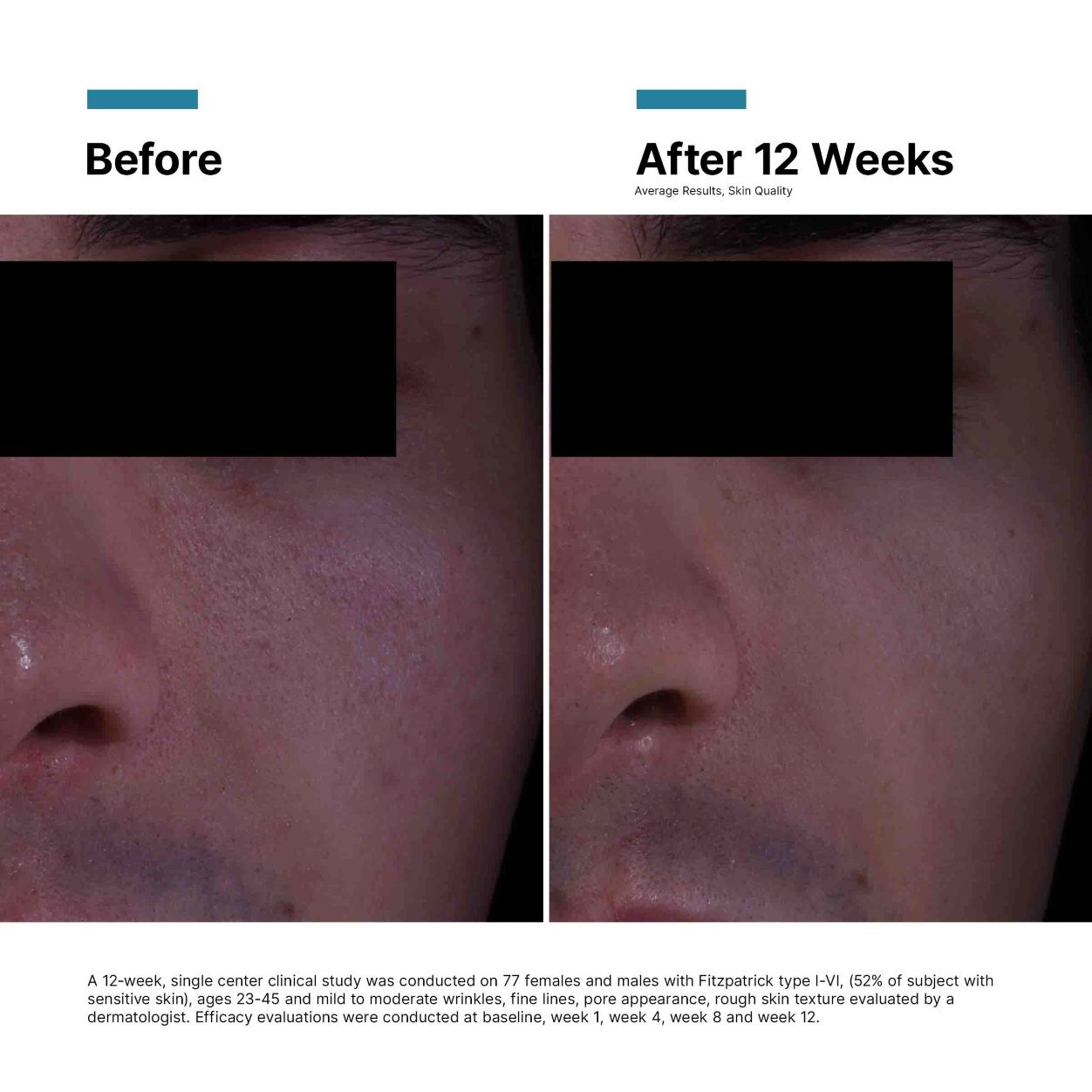 Before and after results of using P-TIOX Cream variant: Default Title