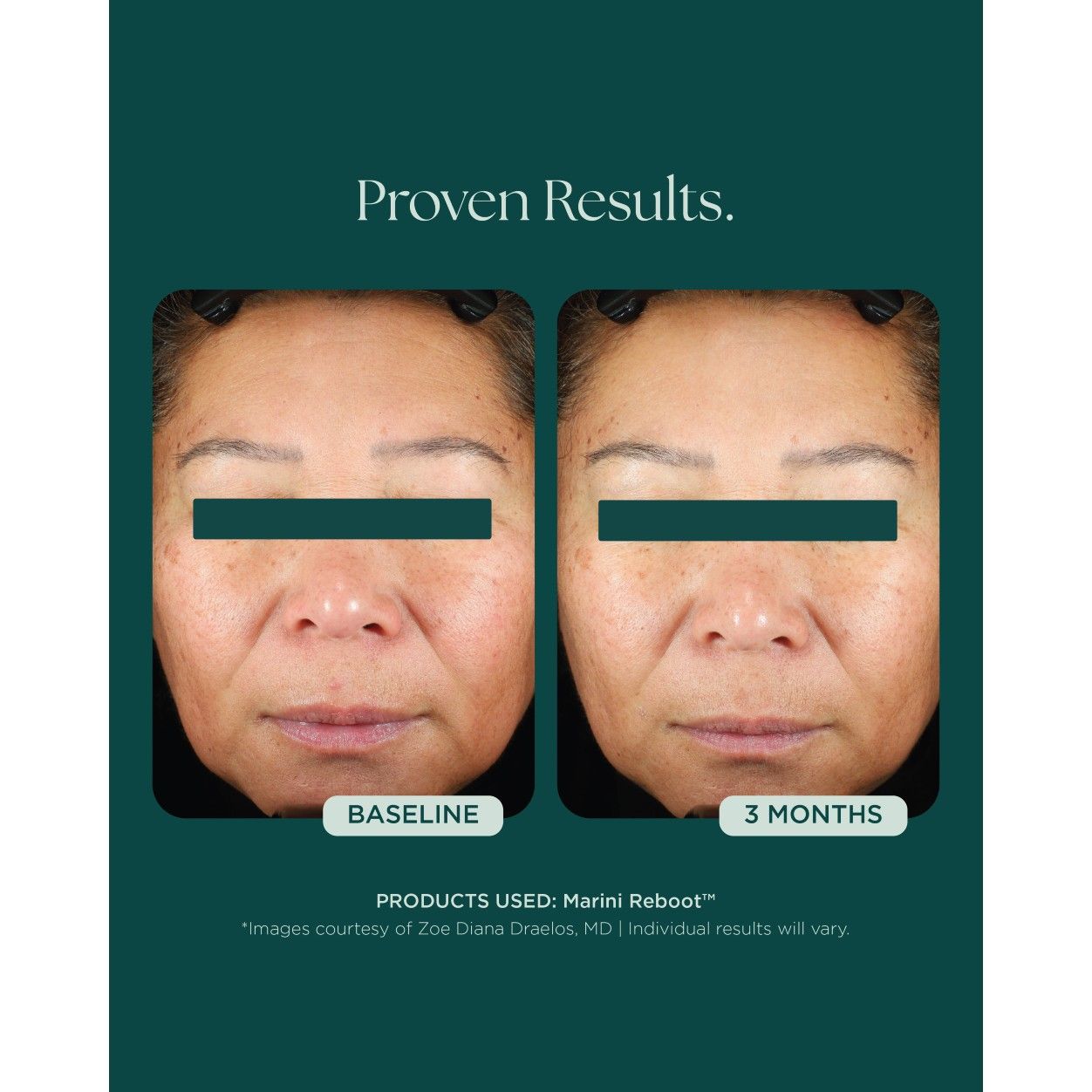 Before and after results of using variant: Default Title