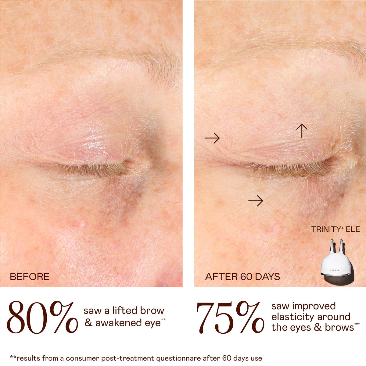 Close-up comparison of an eye before and after 60 days of using the NuFace Trinity+ Lifting & Smoothing Lip & Eye Microcurrent Attachment, with arrows indicating lifted areas and text reporting 80% saw a lifted brow and 75% improved elasticity.