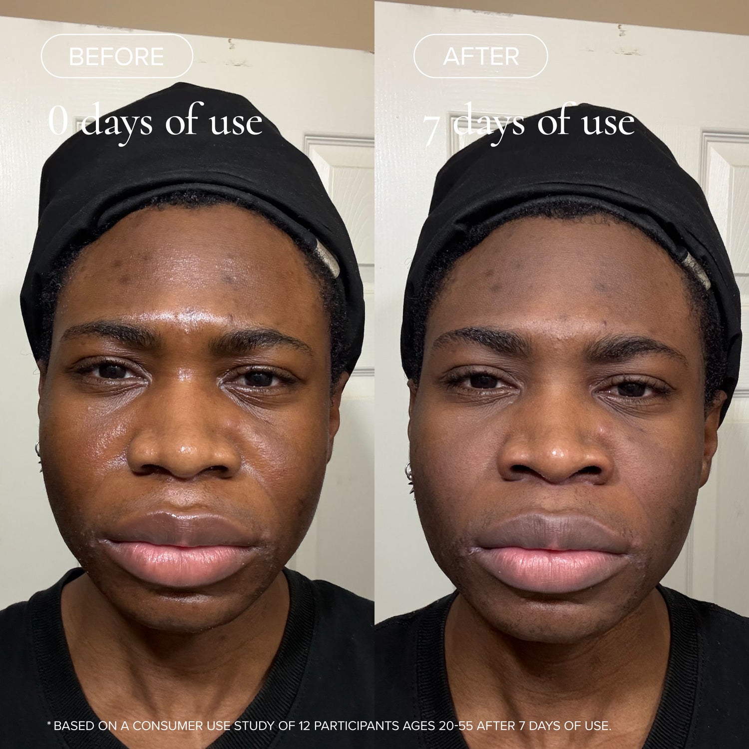 Before and after results of using variant: Default Title