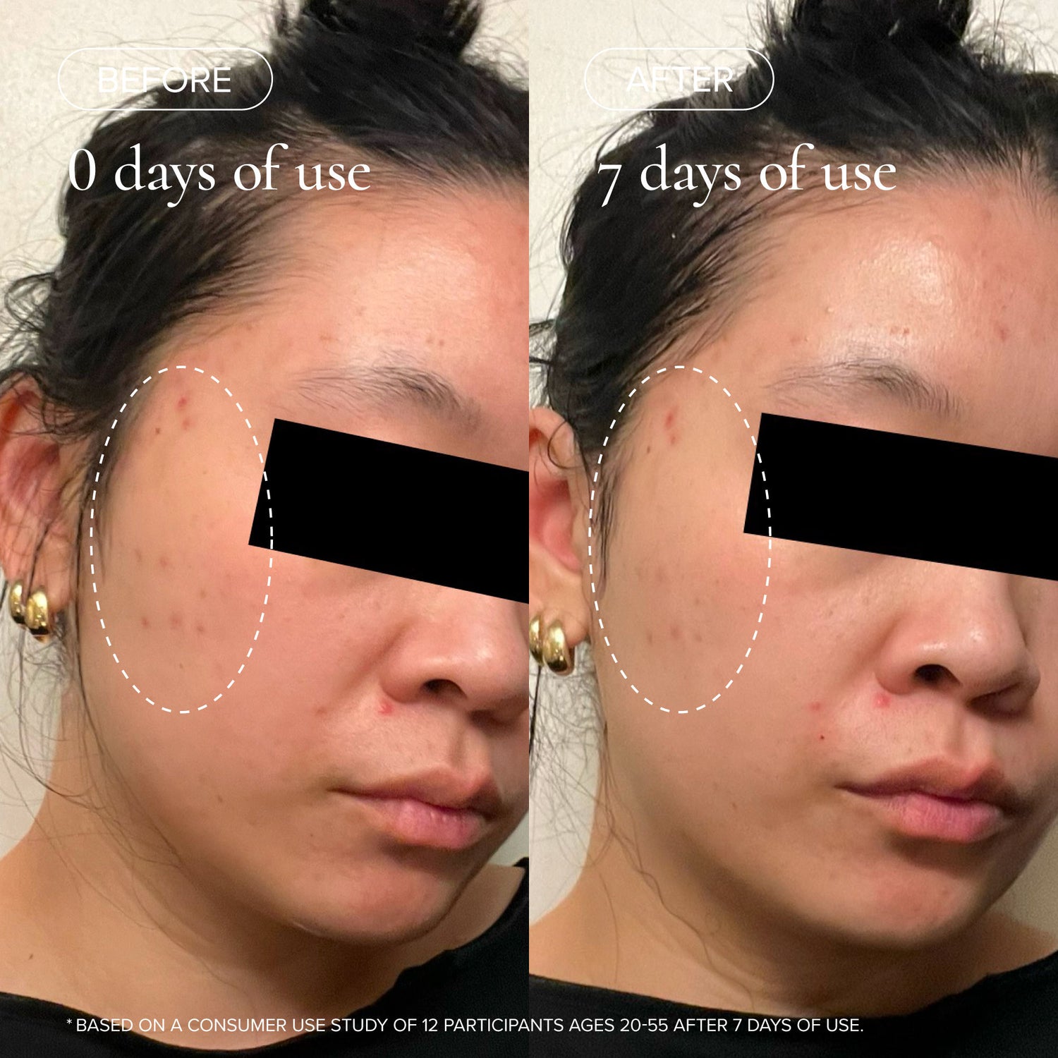 Before and after results of using variant: Default Title