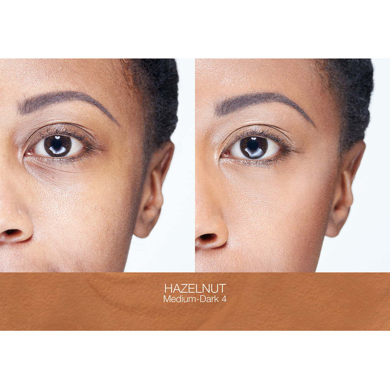 Before and after results of using Nars Soft Matte Complete Concealer variant: Hazelnut