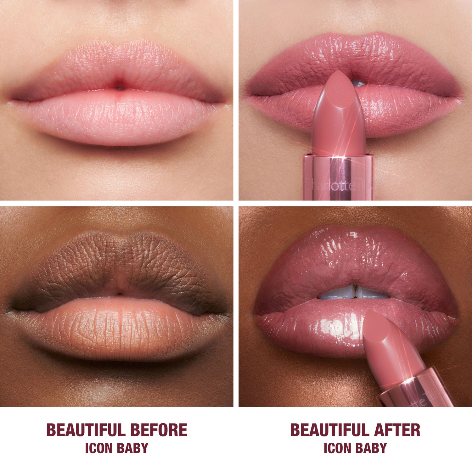Before and after results of using Charlotte Tilbury K.I.S.S.I.N.G. Lipstick variant: Icon Baby