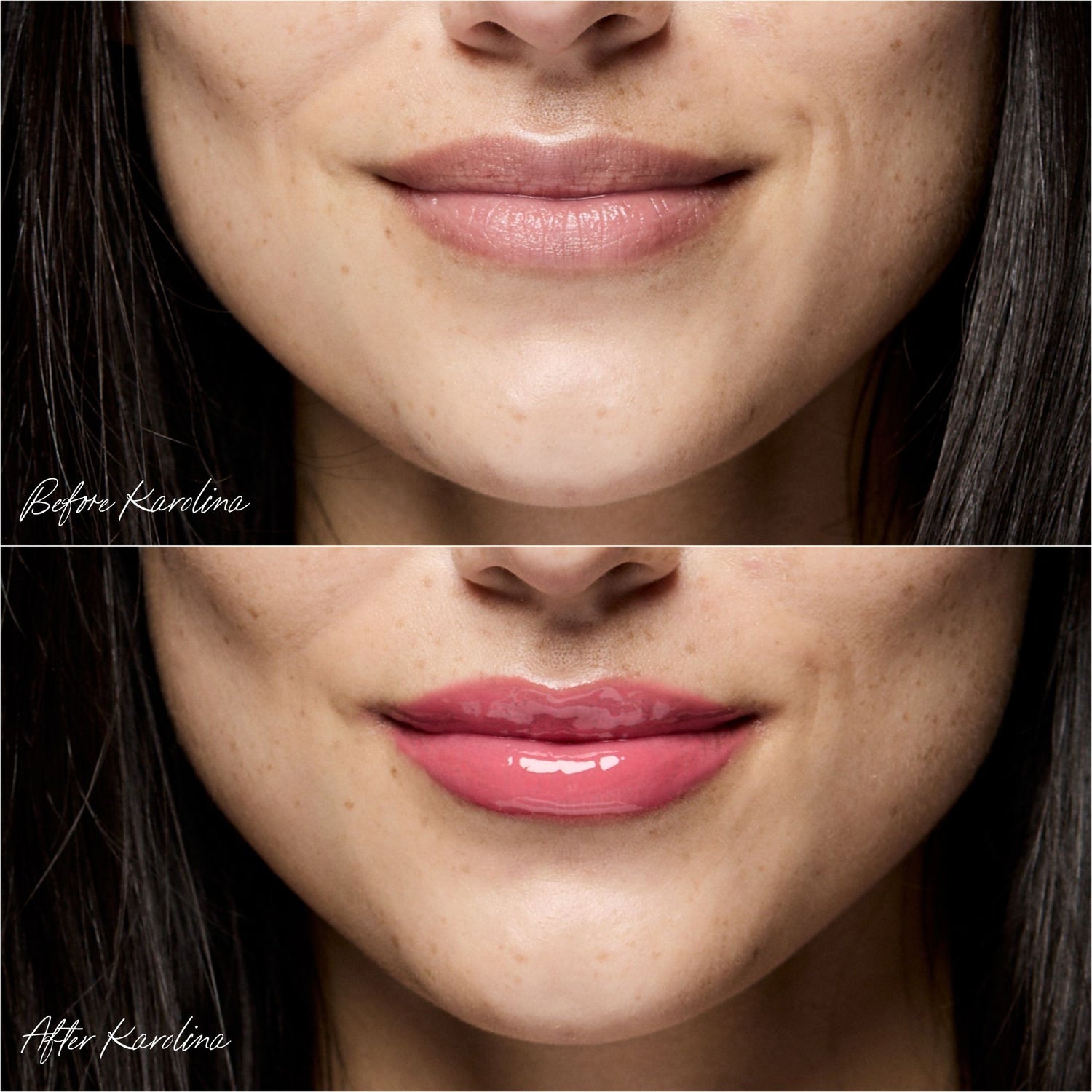 Before and after results of using RMS Beauty Legendary Lip Oil variant: Karolina