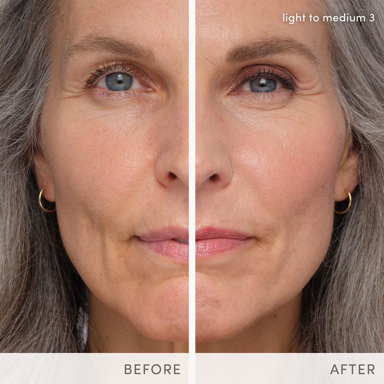 Before and after results of using Jane Iredale HydroPure Tinted Serum variant: Light to Medium 3