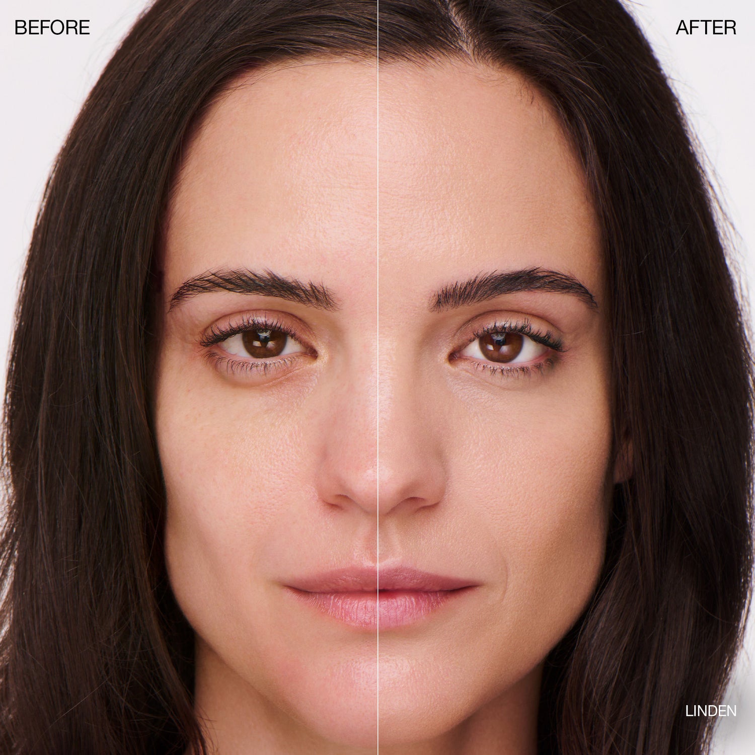 Before and after results of using Ogee Complexion Perfecting Tinted Serum variant: Linden - 1.25N