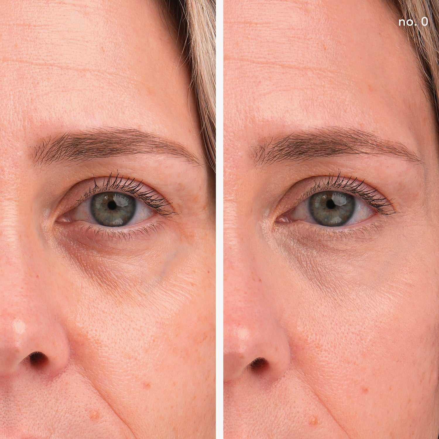 Before and after results of using Jane Iredale Enlighten Plus Under-Eye Concealer variant: No.0