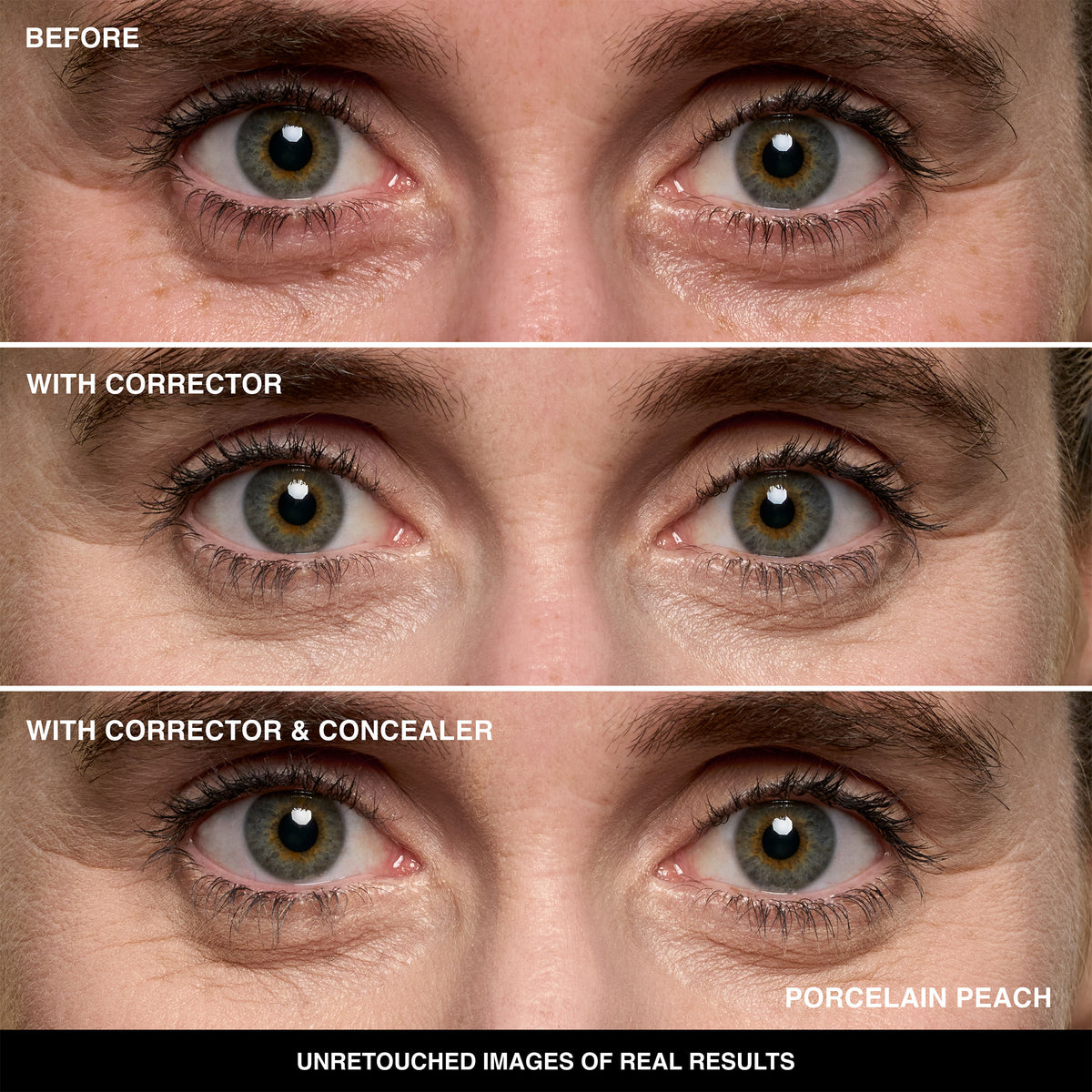 Before and after results of using Bobbi Brown Skin Corrector Stick variant: Porcelain Peach