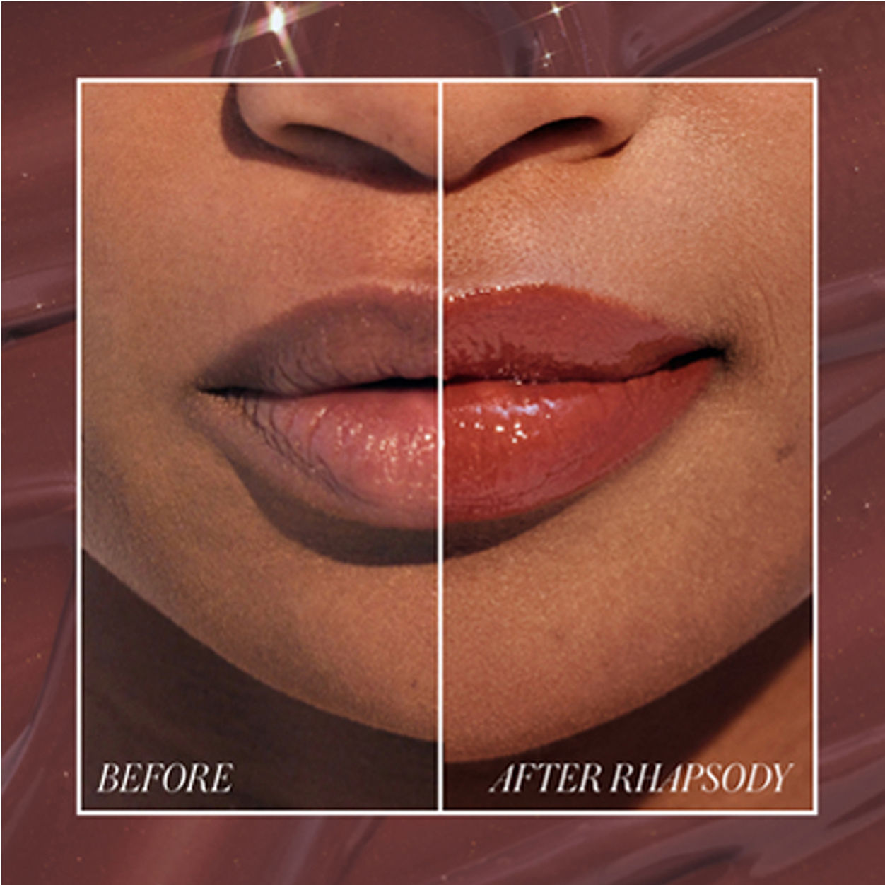 Before and after results of using RMS Beauty Liplights variant: Rhapsody
