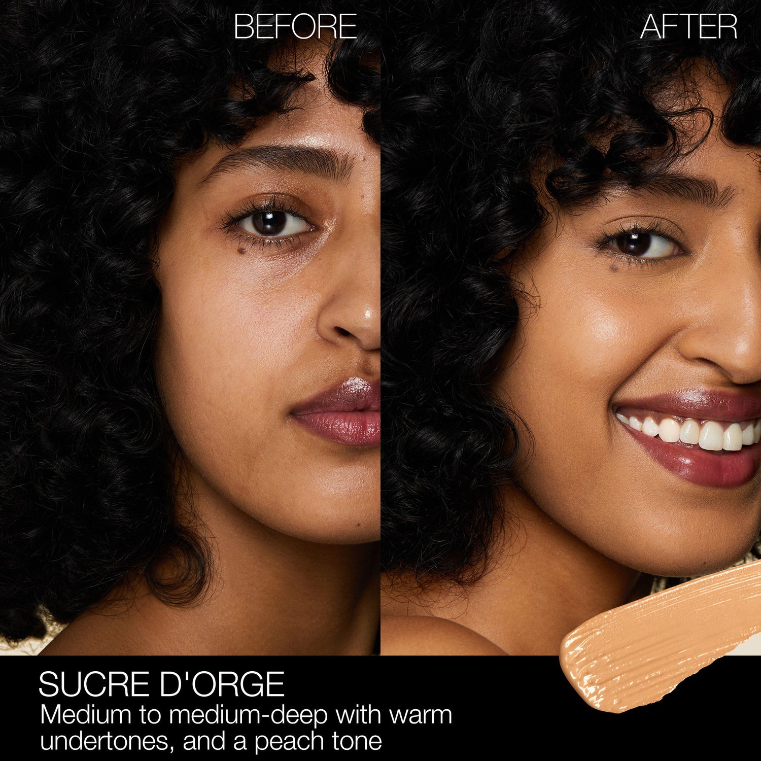 Before and after results of using Nars Radiant Creamy Concealer variant: Sucre D'Orge MD1.5