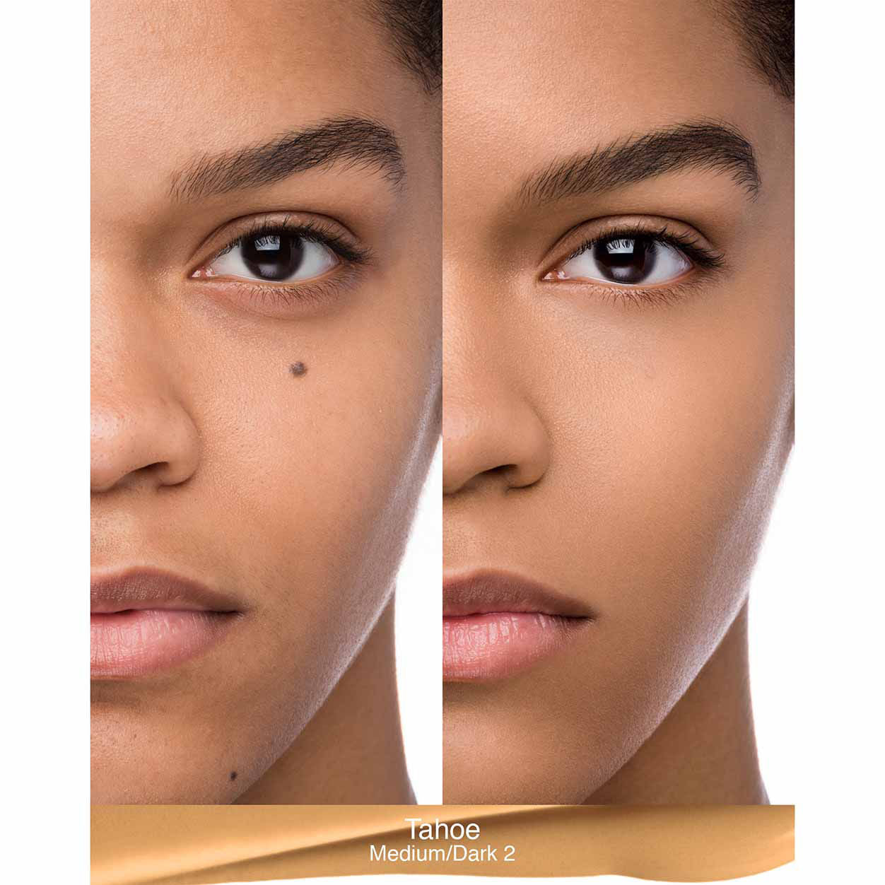 Before and after results of using Nars Natural Radiant Longwear Foundation variant: Tahoe MD2