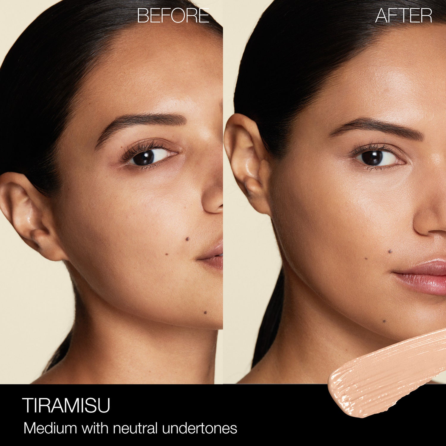 Before and after results of using Nars Radiant Creamy Concealer variant: Tiramisu M1.75