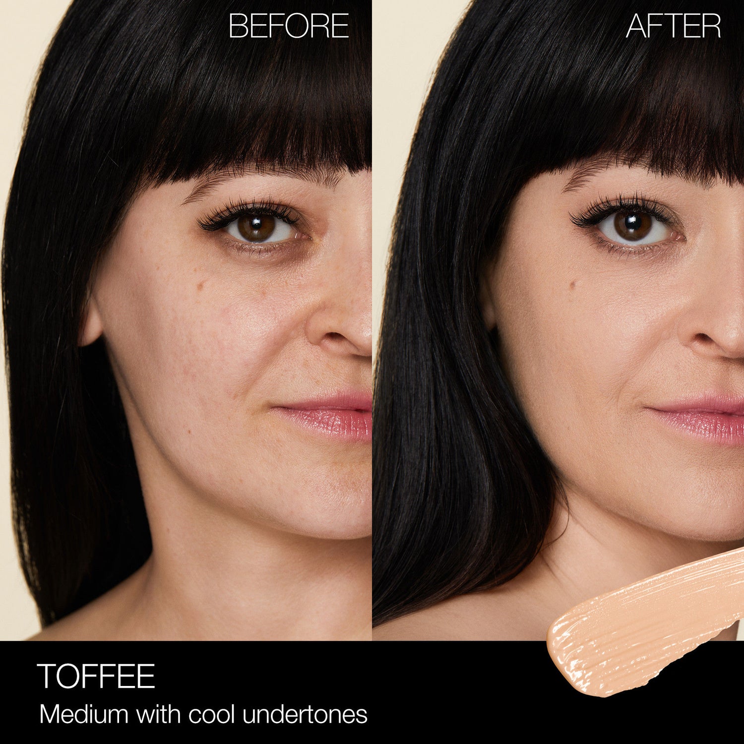 Before and after results of using Nars Radiant Creamy Concealer variant: Toffee M1.25