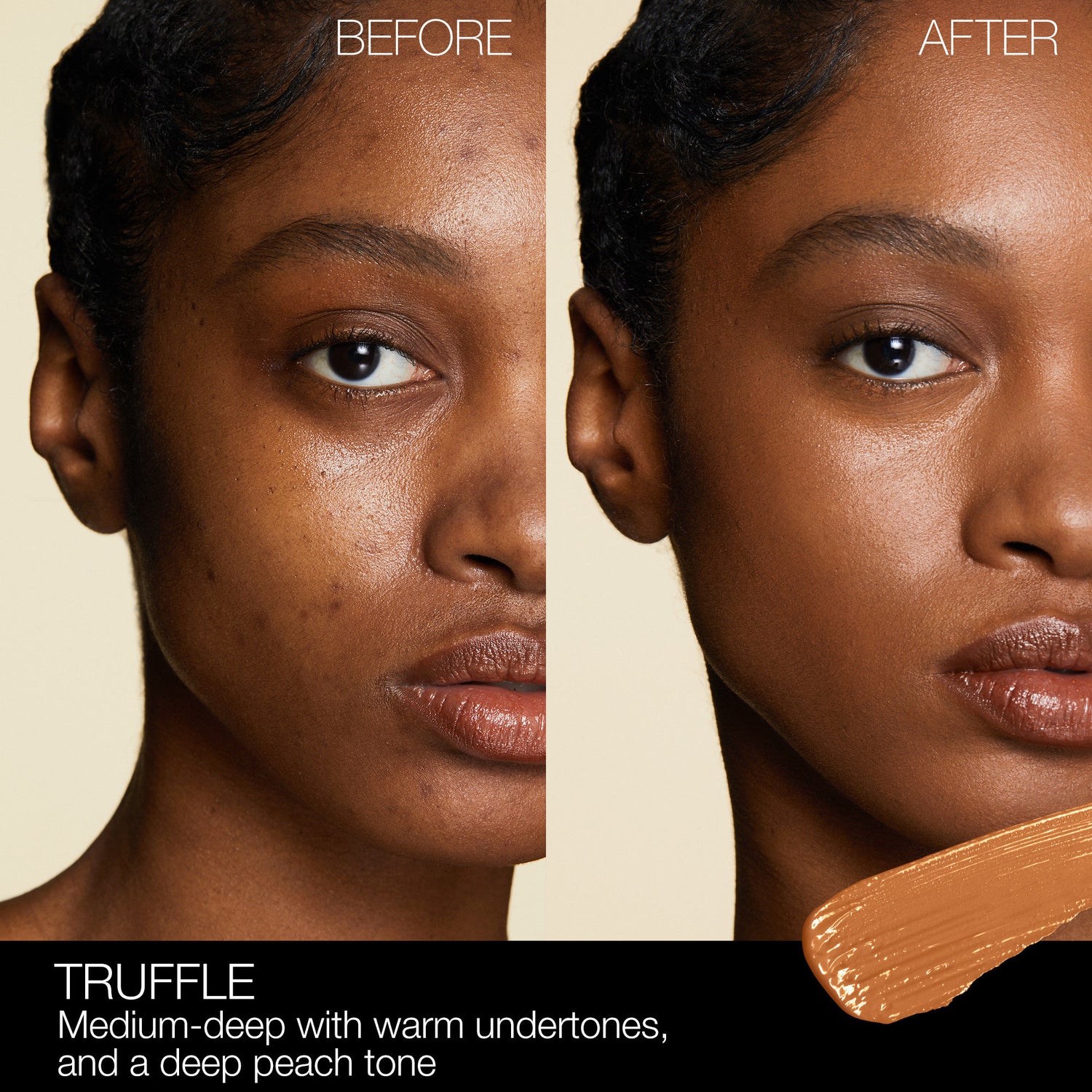Before and after results of using Nars Radiant Creamy Concealer variant: Truffle MD2.75