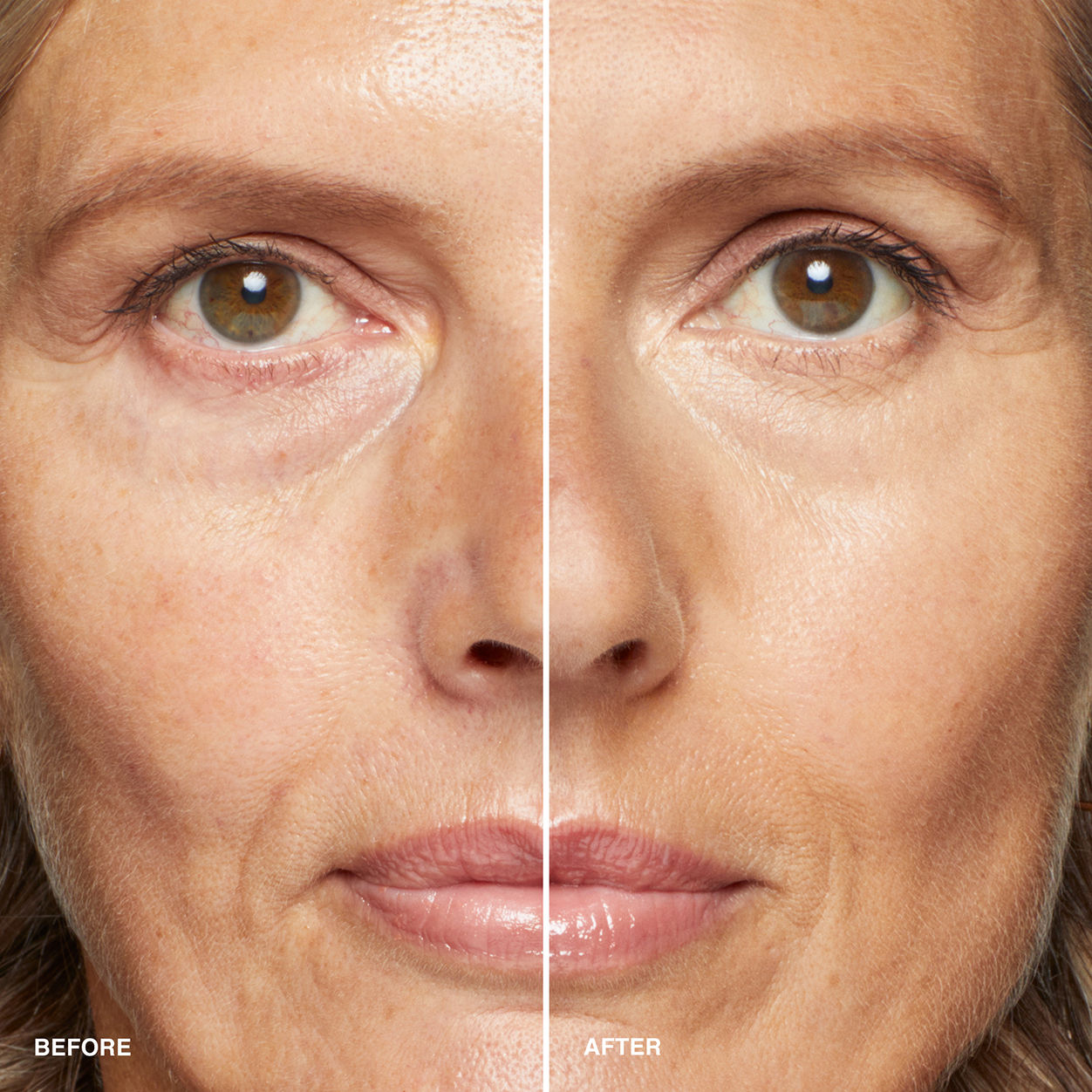 Before and after results of using Bobbi Brown Skin Concealer Stick variant: Warm Beige