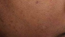 Discoloration Defense