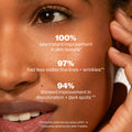 Dermaflash Luxe+