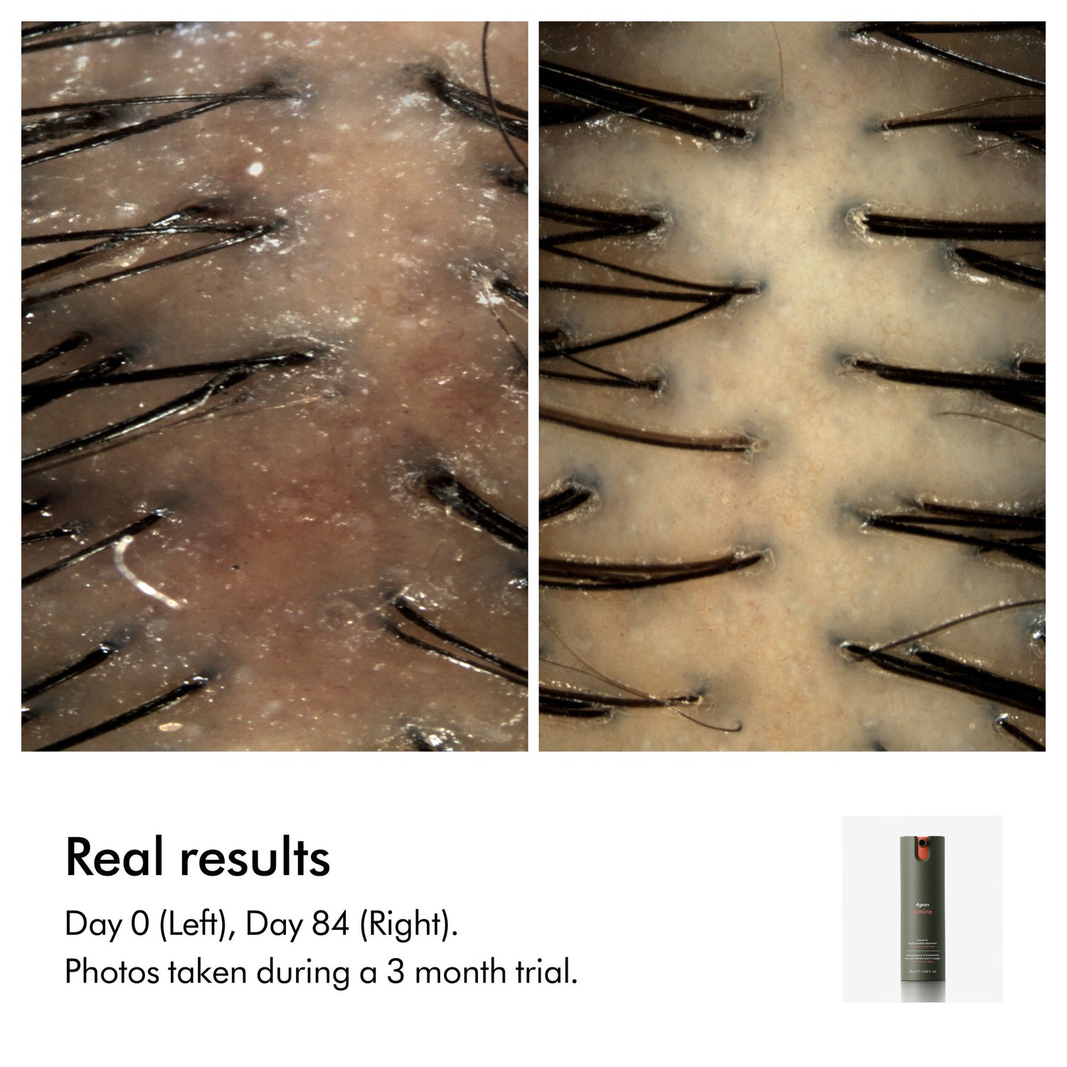 Before and after results of using Dyson Amino Balance & Strengthen Scalp Treatment for Fuller Looking Hair