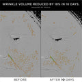 Before and after results of using Noble Panacea The Exceptional RetiNAD+ Renewal Booster