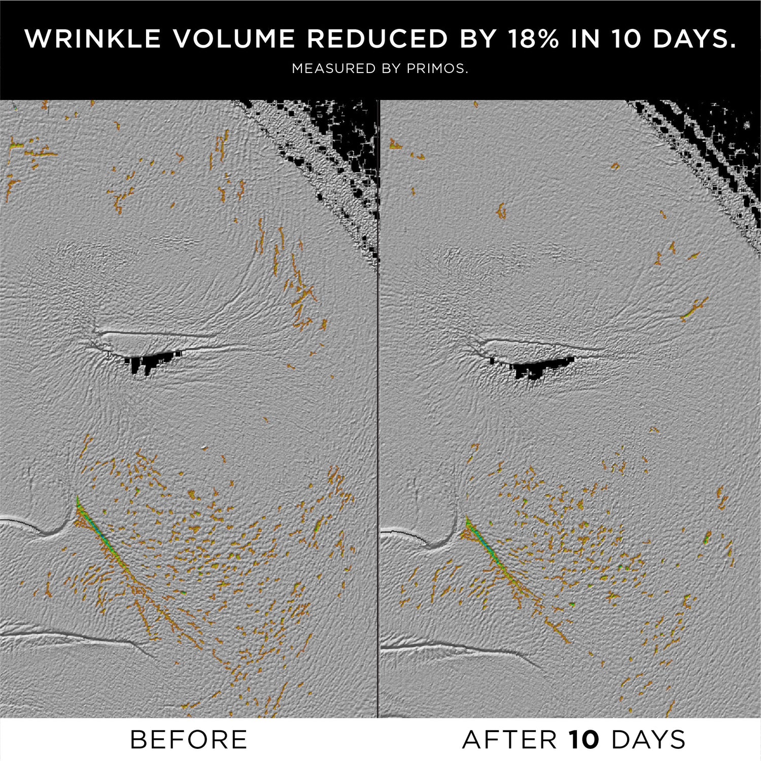 Before and after results of using Noble Panacea The Exceptional RetiNAD+ Renewal Booster