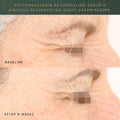Before and after results of using Irene Forte Irene's Rejuvenating Night Routine Kit (Limited Edition)