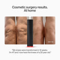 Before and after results of using LYMA LYMA Laser Starter Kit