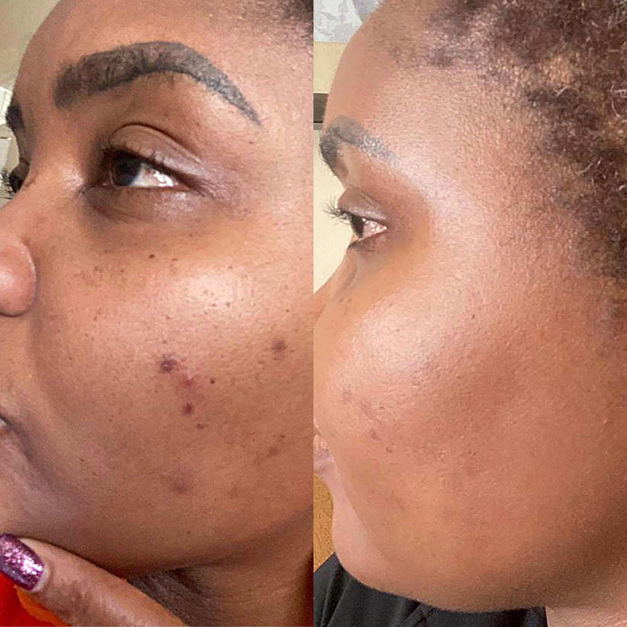 Before and after results of using BalmLabs ClearBalm Power Elixir