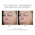 Before and after results of using SkinMedica Total Defense + Repair Broad Spectrum SPF 34 Sunscreen