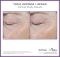 Before and after results of using SkinMedica Total Defense + Repair Broad Spectrum SPF 34 Sunscreen