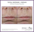Before and after results of using SkinMedica Total Defense + Repair Broad Spectrum SPF 34 Sunscreen