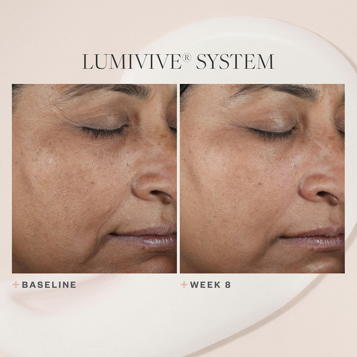 Before and after results of using SkinMedica Lumivive System, Day and Night