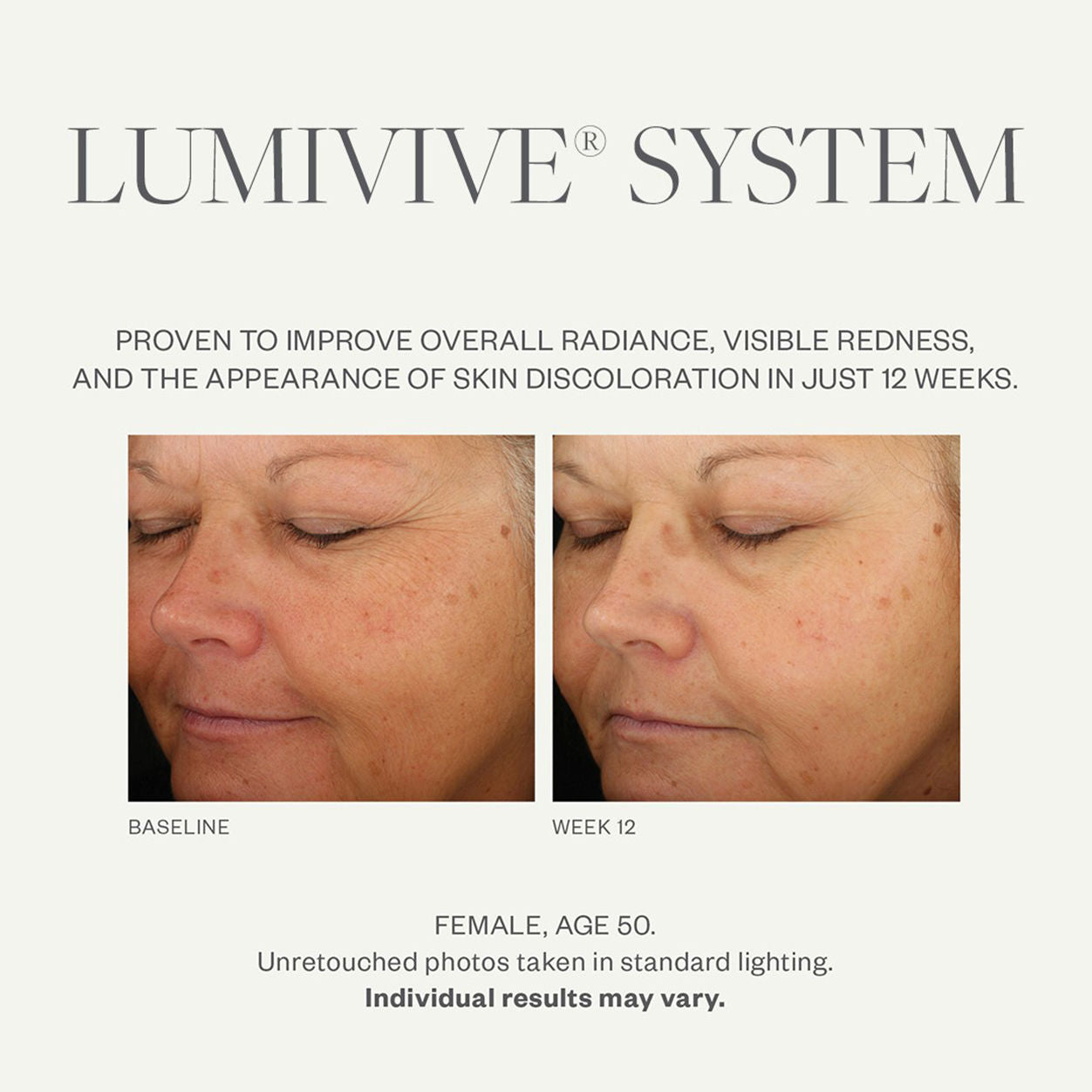 Before and after results of using SkinMedica Lumivive System, Day and Night