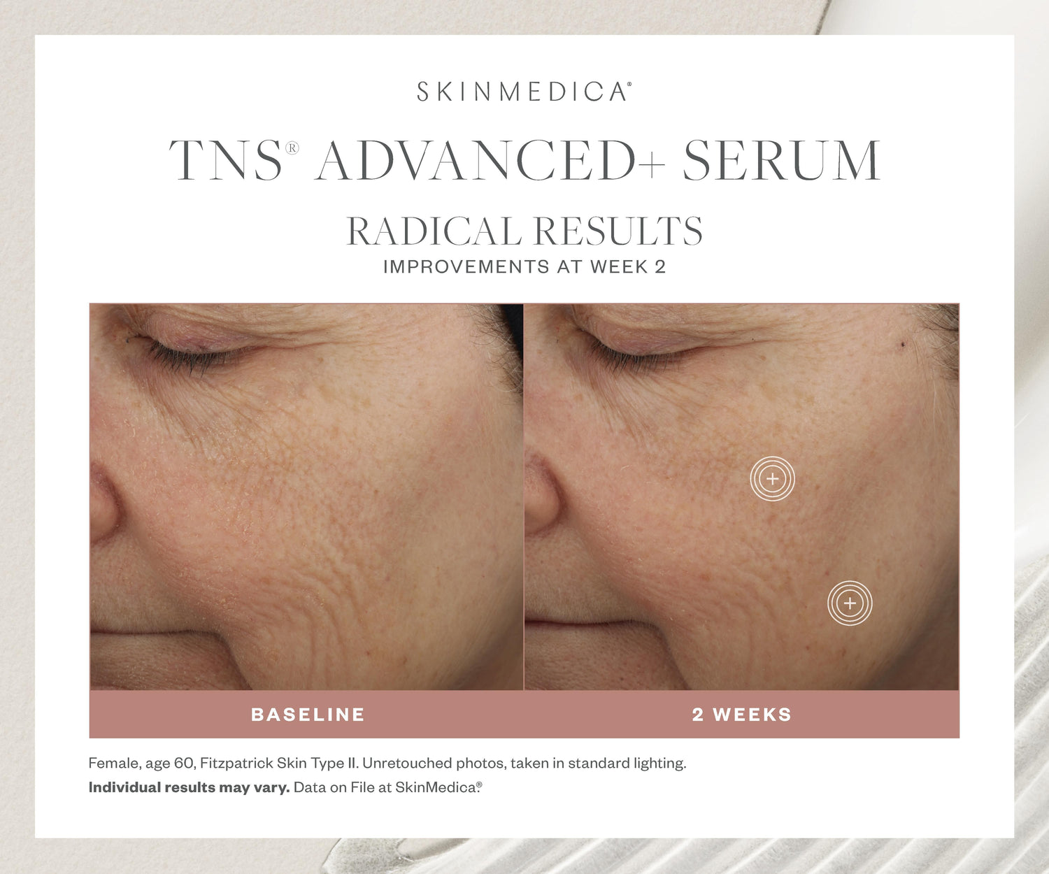 Before and after results of using SkinMedica TNS Advanced+ Serum