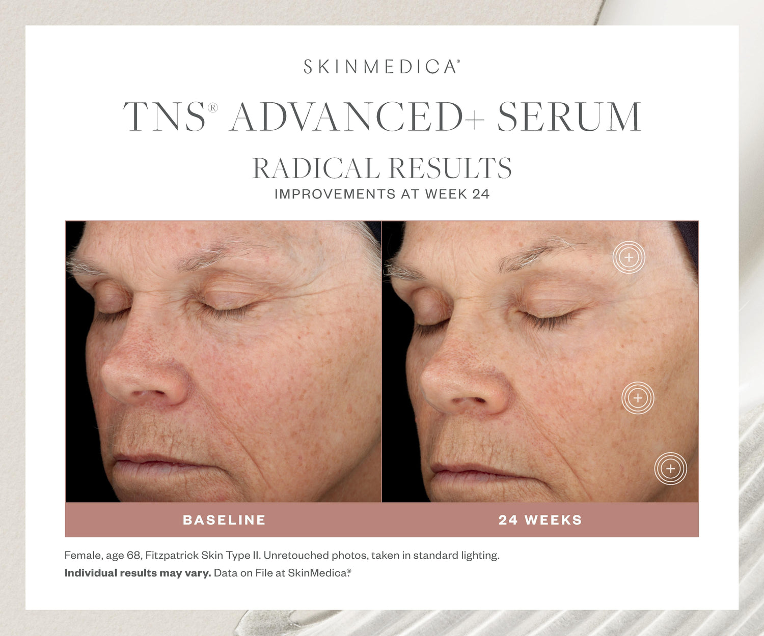 Before and after results of using SkinMedica TNS Advanced+ Serum