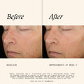 Information related to SkinMedica Even & Correct Brightening Treatment Pads