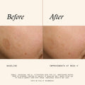 Information related to SkinMedica Even & Correct Dark Spot Cream