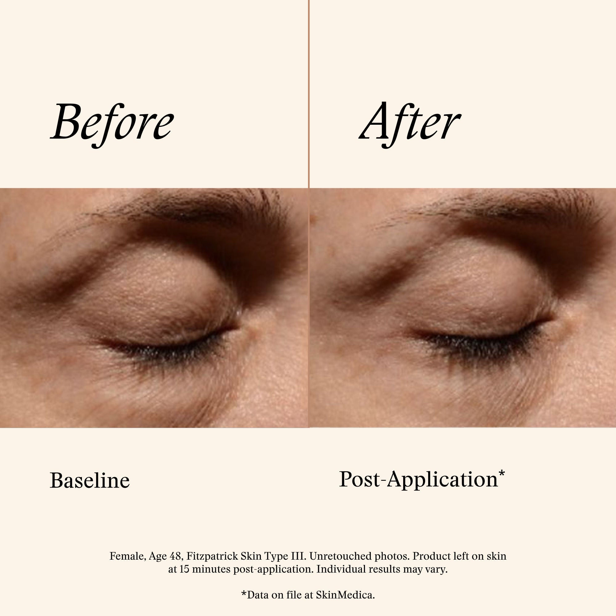 SkinMedica Instant Bright Eye Cream – SkinMedica – bluemercury