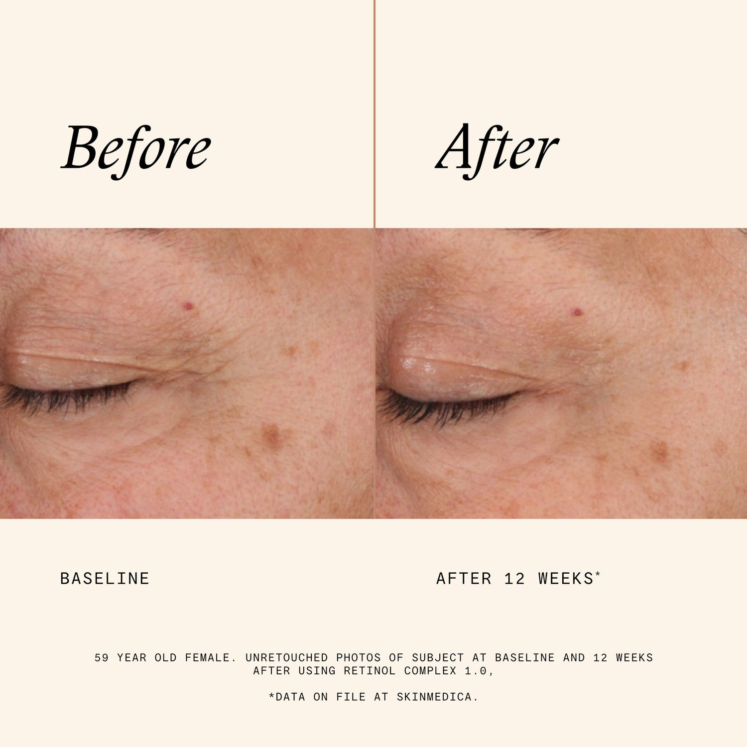 Information related to SkinMedica Retinol Complex 1.0