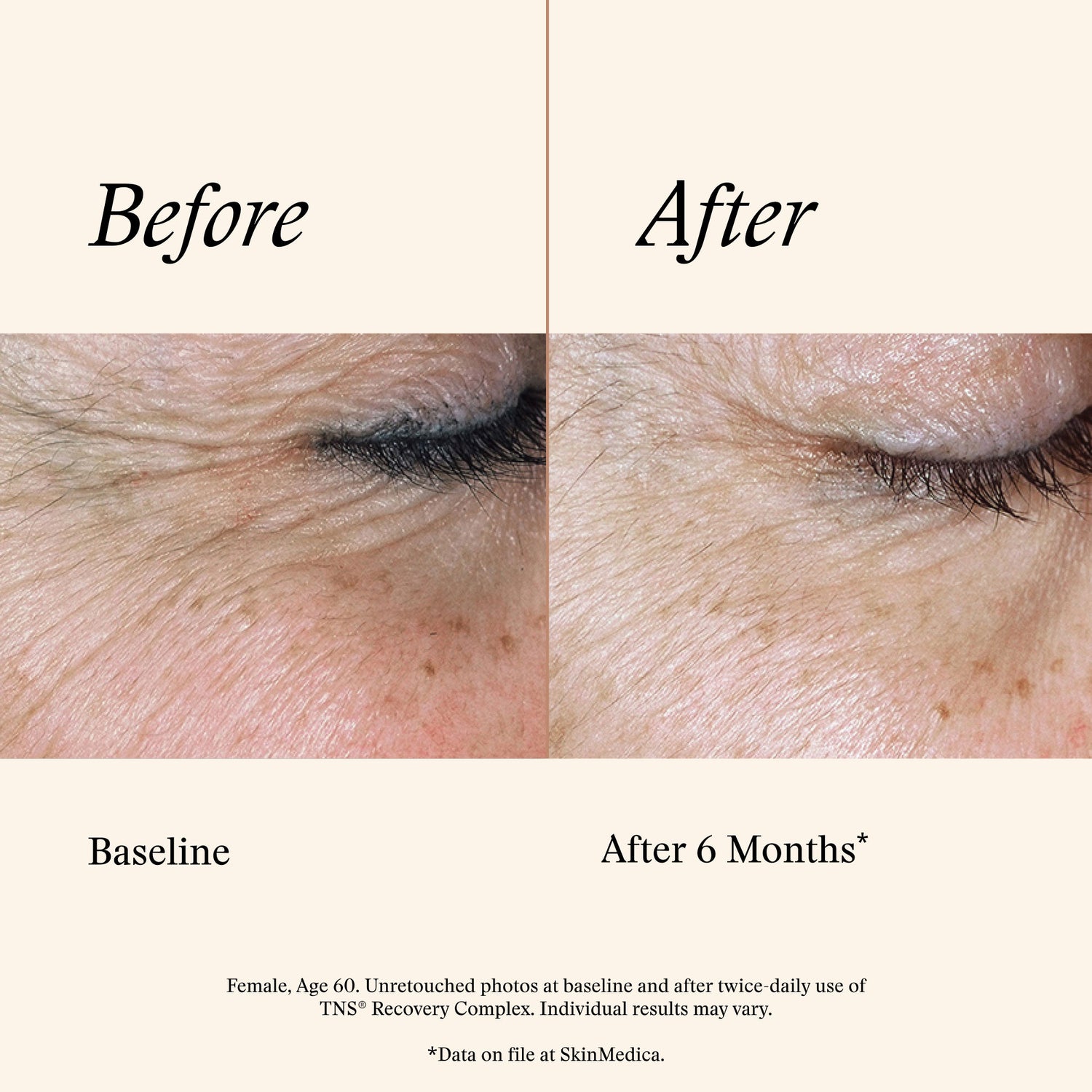 Information related to SkinMedica TNS Recovery Complex