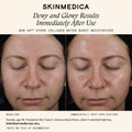 Information related to SkinMedica HA5 Hydra Collagen Water Burst Moisturizer