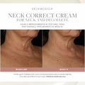 Before and after results of using SkinMedica Neck Correct Cream