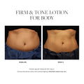 Before and after results of using SkinMedica Firm & Tone Lotion For Body