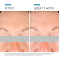 SkinCeuticals A.G.E. Interrupter Advanced before and after image .