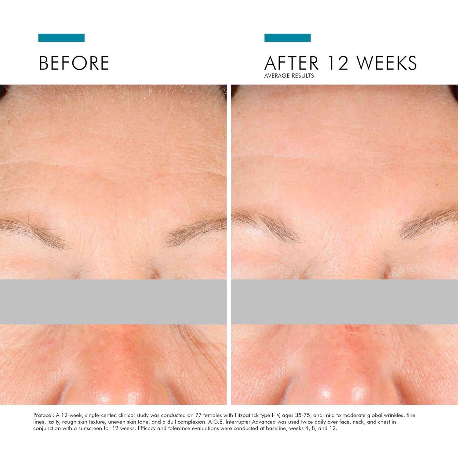 SkinCeuticals A.G.E. Interrupter Advanced before and after image .