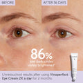 Before and after results of using Caudalie Vinoperfect Dark Circle Brightening Eye Cream