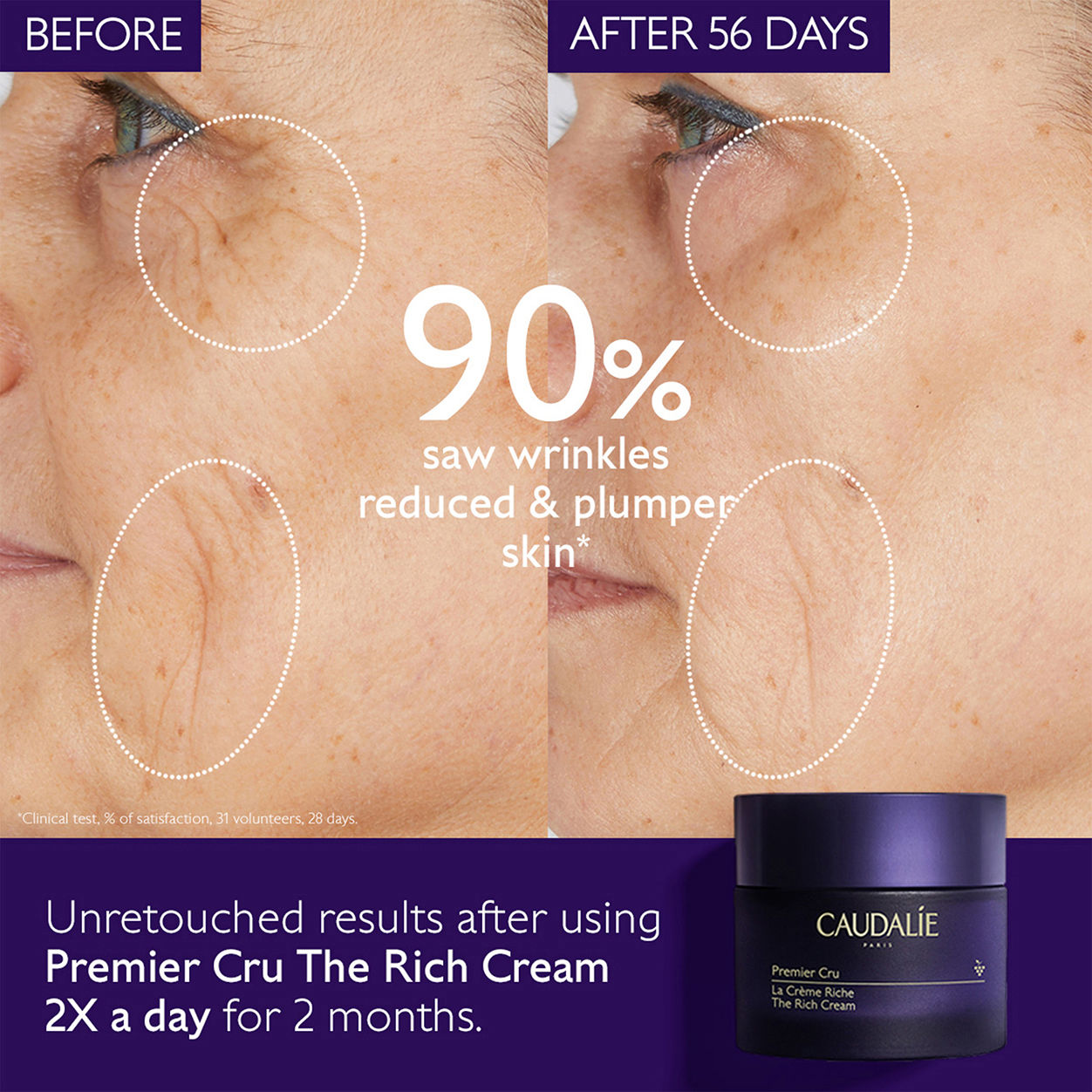 Before and after results of using Caudalie Premier Cru Rich Cream Moisturizer