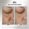 Before and after results of using Kiehl's Since 1851 Rare Earth Pore Cleansing Masque