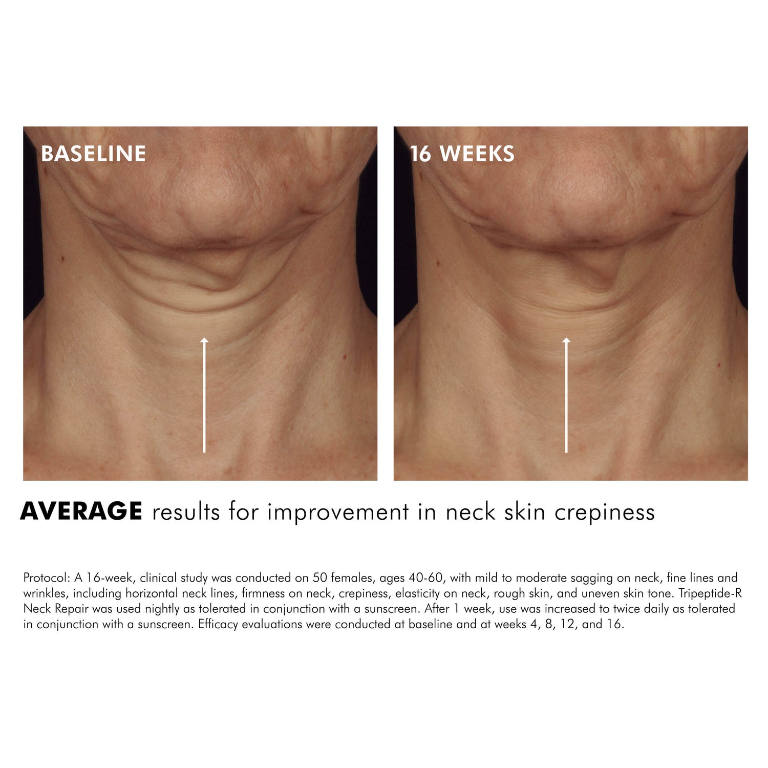 SkinCeuticals Tripeptide-R Neck Repair before and after image .